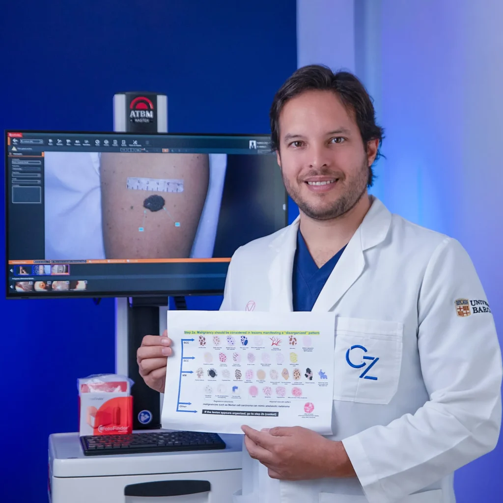 Melanoma y Cáncer de piel