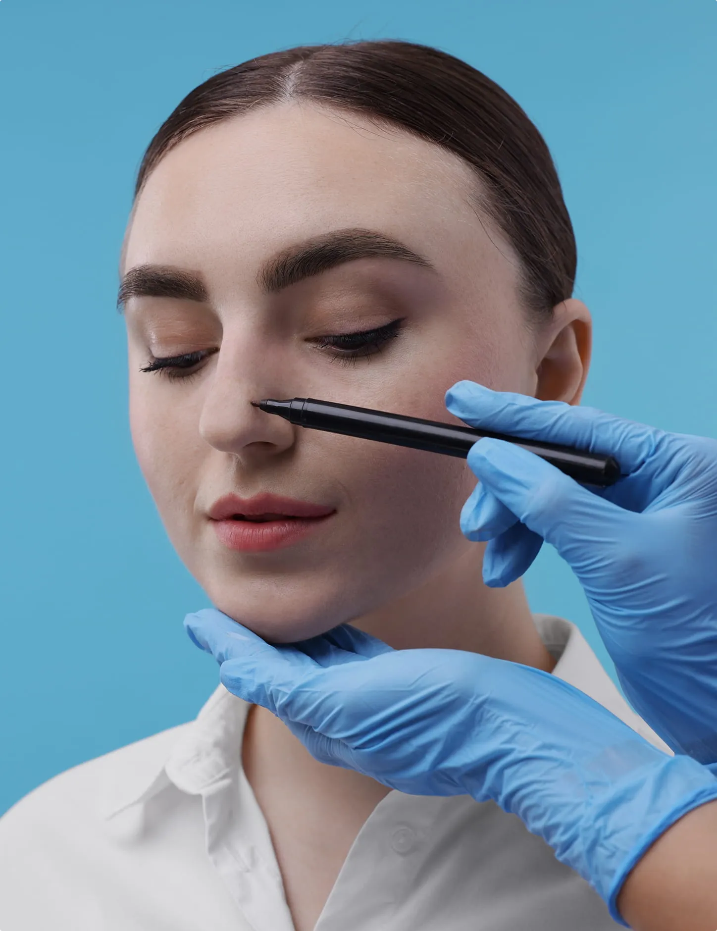 Rinoplastia