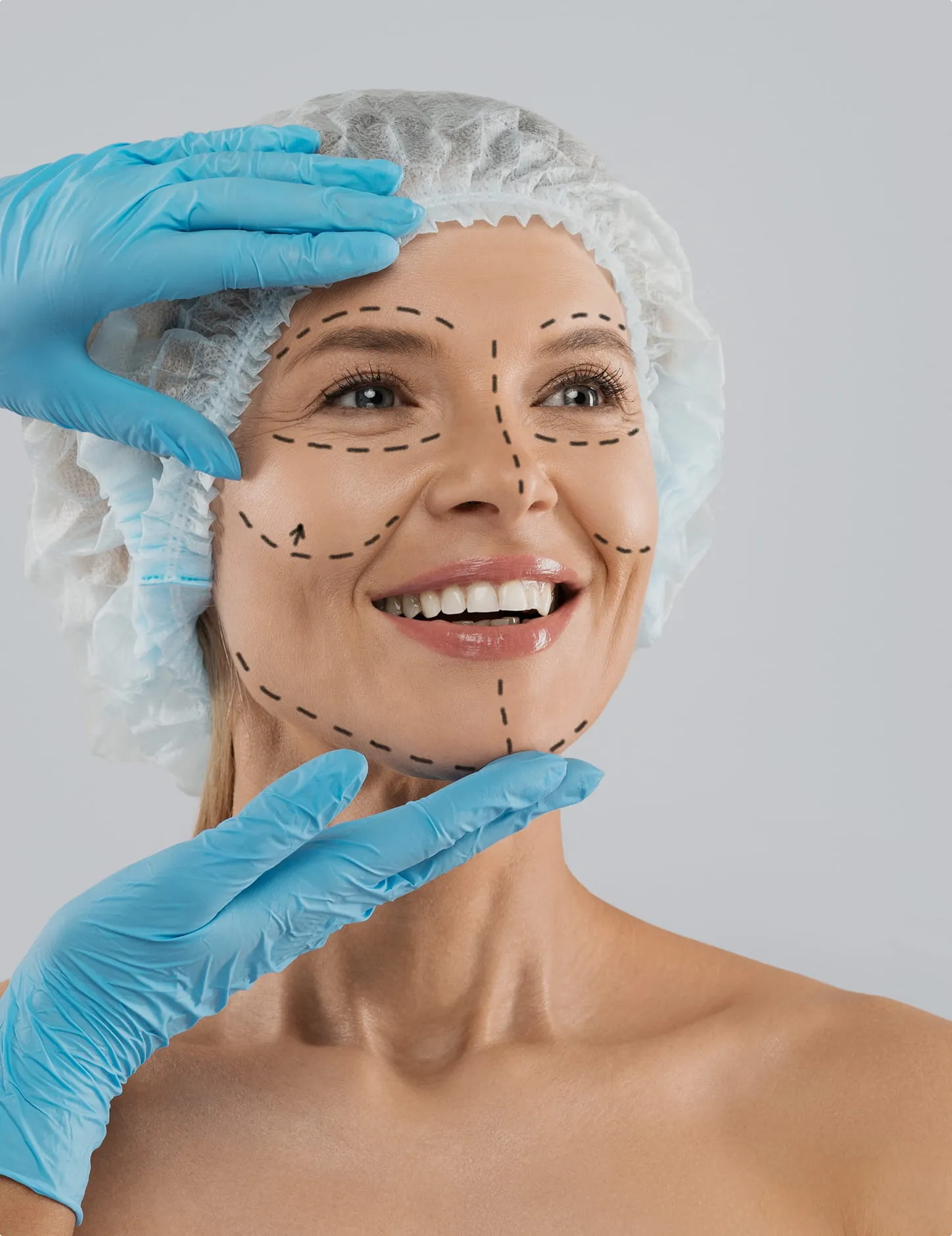 Cirugía facial